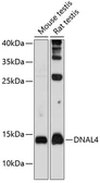Anti-DNAL4 antibody used in Western Blot (WB). GTX65571