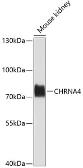 Anti-AChR alpha 4 antibody used in Western Blot (WB). GTX65576