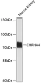 Anti-AChR alpha 4 antibody used in Western Blot (WB). GTX65576