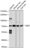 Anti-SQLE antibody used in Western Blot (WB). GTX65578
