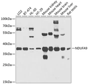 Anti-NDUFA9 antibody used in Western Blot (WB). GTX65579