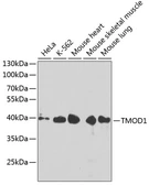 Anti-Tropomodulin 1 antibody used in Western Blot (WB). GTX65580
