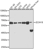 Anti-ZC3H15 antibody used in Western Blot (WB). GTX65585