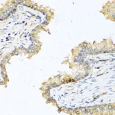 Anti-DEFB121 antibody used in IHC (Paraffin sections) (IHC-P). GTX65588