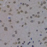Anti-POLR2L antibody used in IHC (Paraffin sections) (IHC-P). GTX65590