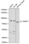 Anti-TRMT1 antibody used in Western Blot (WB). GTX65595