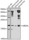 Anti-UBE2NL antibody used in Western Blot (WB). GTX65599