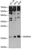 Anti-Gemin 6 antibody used in Western Blot (WB). GTX65613