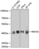 Anti-RNF34 antibody used in Western Blot (WB). GTX65614