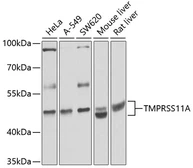 Anti-TMPRSS11A antibody used in Western Blot (WB). GTX65615