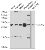 Anti-MAGP1 antibody used in Western Blot (WB). GTX65616