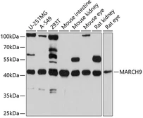 Anti-MARCH9 antibody used in Western Blot (WB). GTX65619