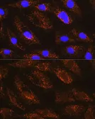 Anti-NDUFA8 antibody used in Immunocytochemistry/ Immunofluorescence (ICC/IF). GTX65622