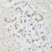 Anti-DHX38 antibody used in IHC (Paraffin sections) (IHC-P). GTX65627