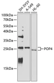 Anti-POP4 antibody used in Western Blot (WB). GTX65628