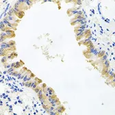 Anti-ALKBH8 antibody used in IHC (Paraffin sections) (IHC-P). GTX65809