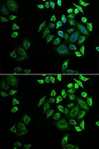 Anti-PLA2G2D antibody used in Immunocytochemistry/ Immunofluorescence (ICC/IF). GTX65810