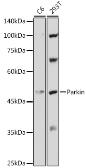 Anti-Parkin antibody used in Western Blot (WB). GTX65812