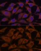 Anti-LZIP antibody used in Immunocytochemistry/ Immunofluorescence (ICC/IF). GTX65817