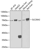 Anti-PiT2 antibody used in Western Blot (WB). GTX65819