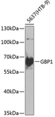 Anti-GBP1 antibody used in Western Blot (WB). GTX65821