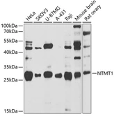 Anti-METTL11A antibody used in Western Blot (WB). GTX65824