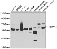 Anti-Hsp 60 antibody used in Western Blot (WB). GTX65826