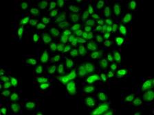 Anti-FBXO7 antibody used in Immunocytochemistry/ Immunofluorescence (ICC/IF). GTX65829