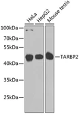 Anti-TRBP2 antibody used in Western Blot (WB). GTX65830