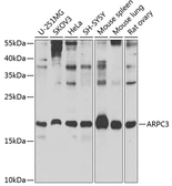 Anti-p21-ARC antibody used in Western Blot (WB). GTX65831