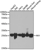 Anti-Adenylate Kinase 4 antibody used in Western Blot (WB). GTX65835