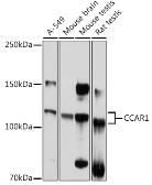 Anti-CCAR1 antibody used in Western Blot (WB). GTX65837