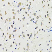 Anti-IKK gamma antibody used in IHC (Paraffin sections) (IHC-P). GTX65841