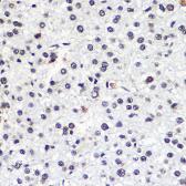 Anti-MSH6 antibody used in IHC (Paraffin sections) (IHC-P). GTX65844