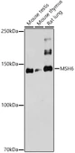 Anti-MSH6 antibody used in Western Blot (WB). GTX65844