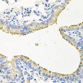 Anti-STRN3 antibody used in IHC (Paraffin sections) (IHC-P). GTX65851