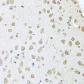 Anti-ThrRS antibody used in IHC (Paraffin sections) (IHC-P). GTX65852