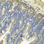 Anti-EIF3S8 antibody used in IHC (Paraffin sections) (IHC-P). GTX65854