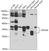 Anti-ZNF346 antibody used in Western Blot (WB). GTX65857