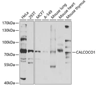 Anti-CoCoA antibody used in Western Blot (WB). GTX65858
