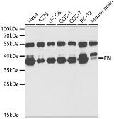 Anti-Fibrillarin antibody used in Western Blot (WB). GTX65859