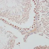 Anti-Cyclin G1 antibody used in IHC (Paraffin sections) (IHC-P). GTX65870