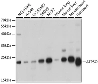 Anti-ATP5O antibody used in Western Blot (WB). GTX65873