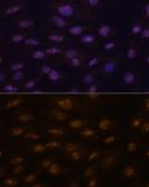 Anti-MyoD1 antibody used in Immunocytochemistry/ Immunofluorescence (ICC/IF). GTX65875