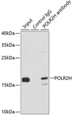 Anti-RPB8 antibody used in Immunoprecipitation (IP). GTX65882