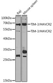 Anti-TIM-3 antibody used in Western Blot (WB). GTX65883