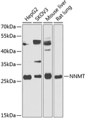 Anti-NNMT antibody used in Western Blot (WB). GTX65885