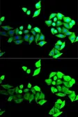 Anti-Bestrophin 1 antibody used in Immunocytochemistry/ Immunofluorescence (ICC/IF). GTX65886