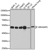 Anti-ARHGAP1 antibody used in Western Blot (WB). GTX65887