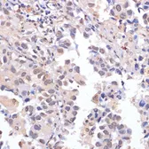 Anti-LRDD antibody used in IHC (Paraffin sections) (IHC-P). GTX65888